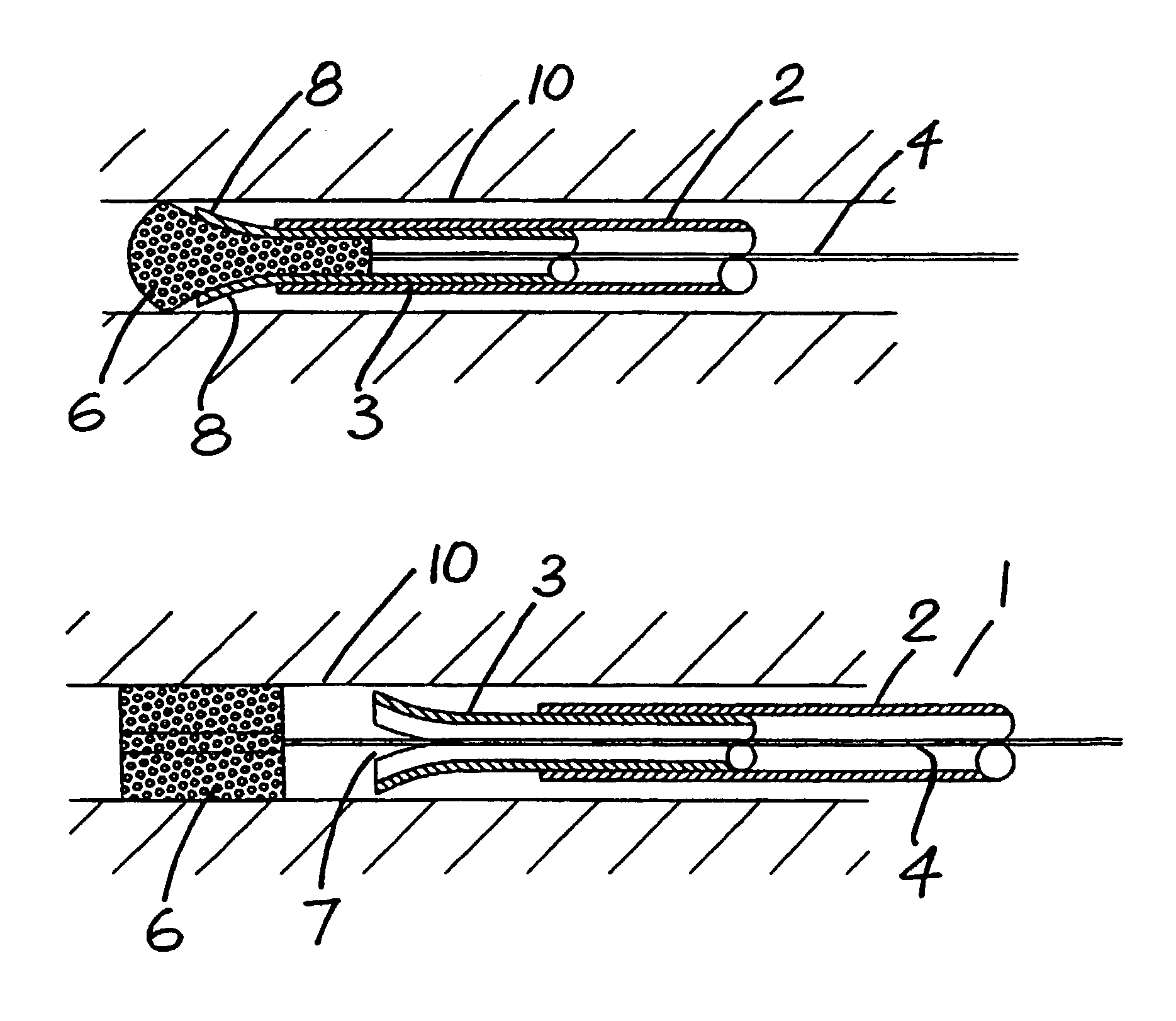 Delivery catheter