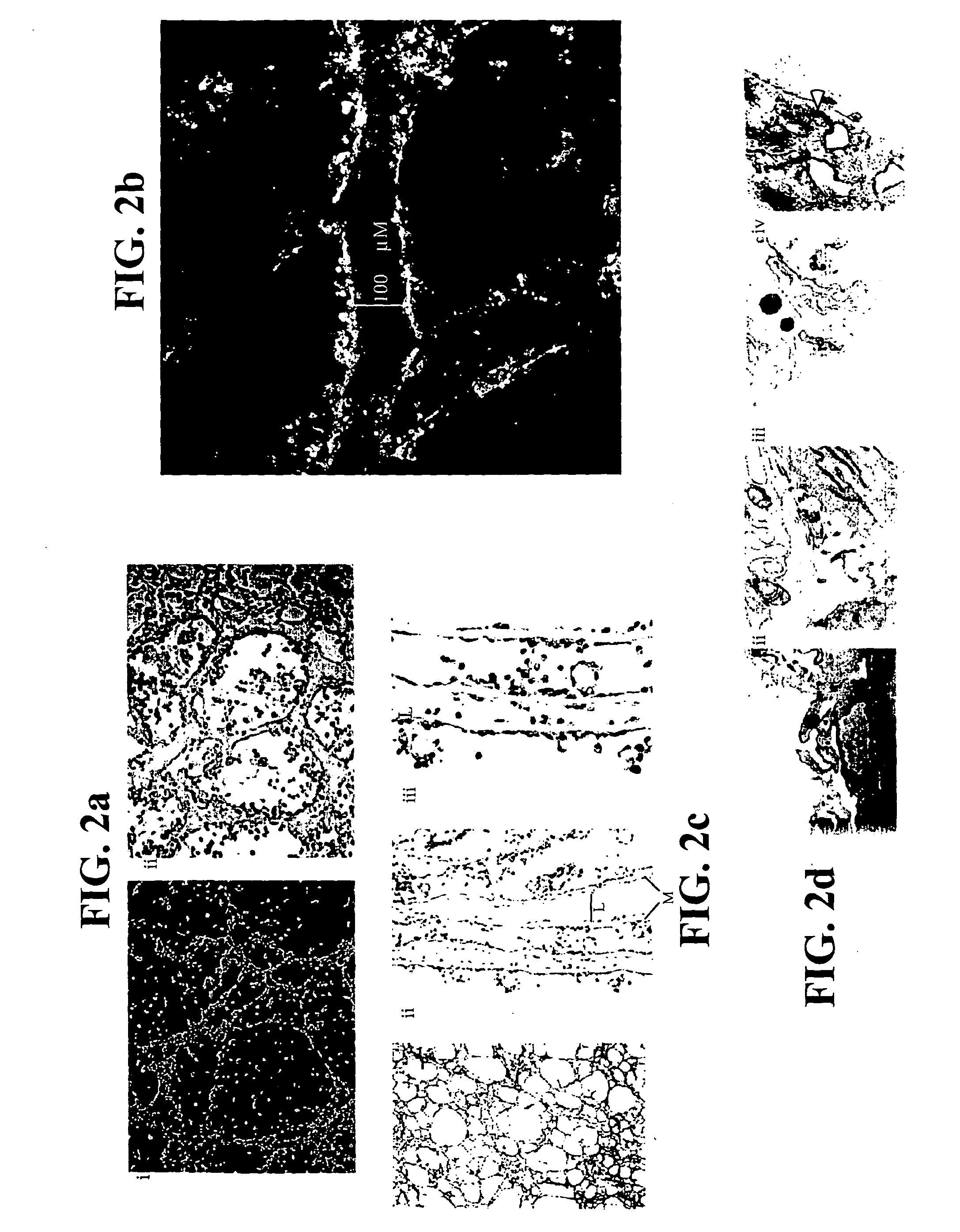 Hemangioblast progenitor cells