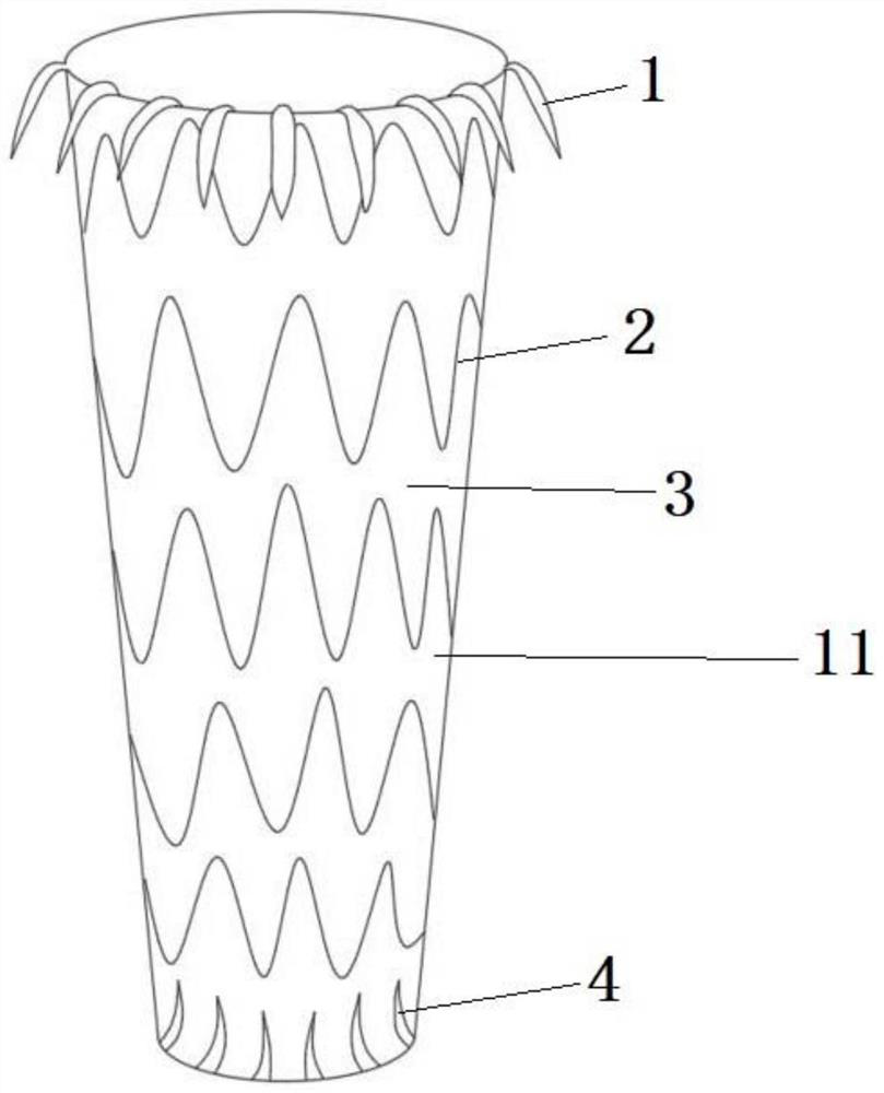 Modularized stent with branches for treating thoracoabdominal aortic aneurysm