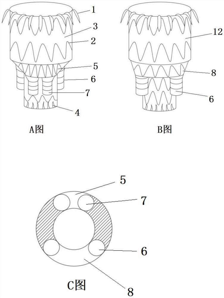 Modularized stent with branches for treating thoracoabdominal aortic aneurysm