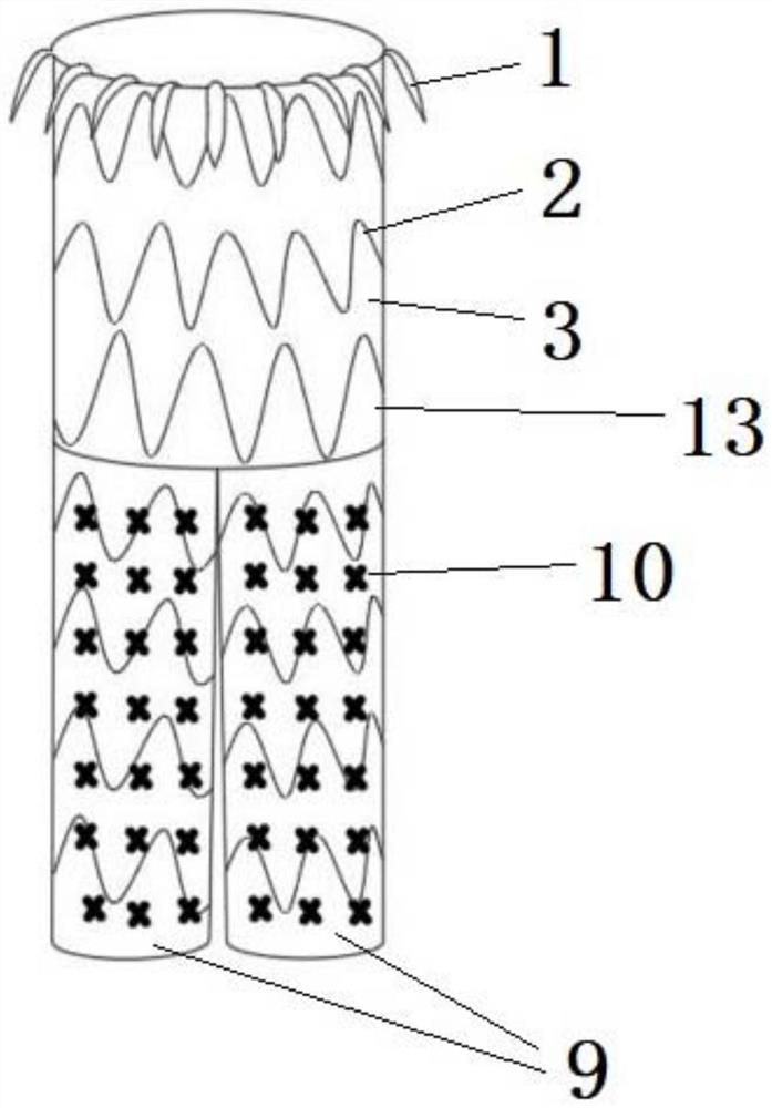 Modularized stent with branches for treating thoracoabdominal aortic aneurysm