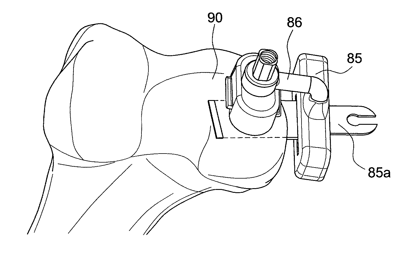 Methods and instruments for forming non-circular cartilage grafts