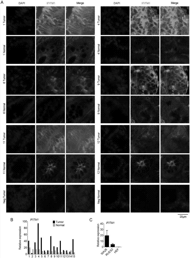 Colorectal cancer biomarker