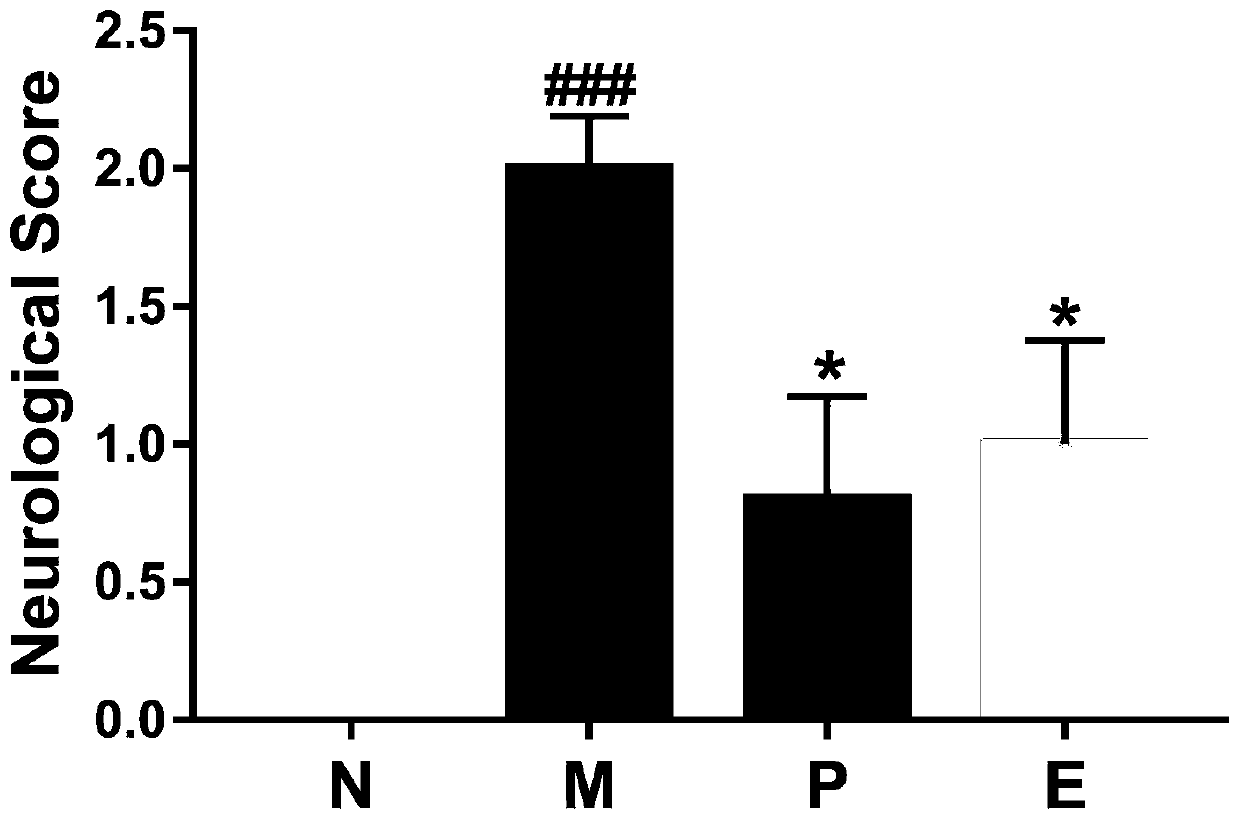 Application of elemicin in medicine