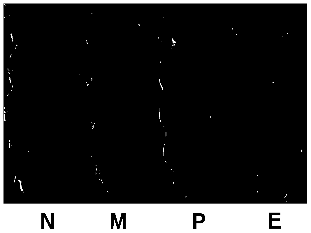 Application of elemicin in medicine