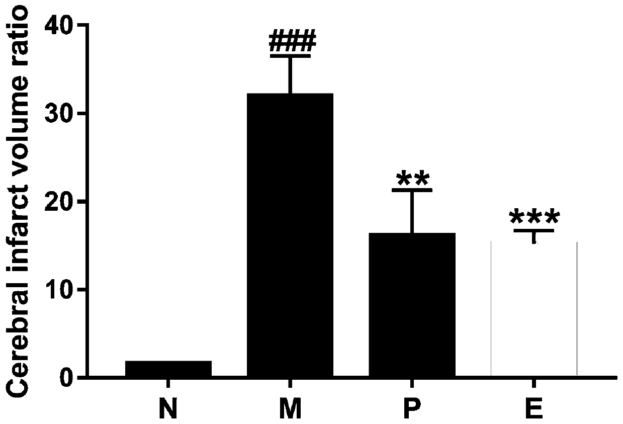 Application of elemicin in medicine