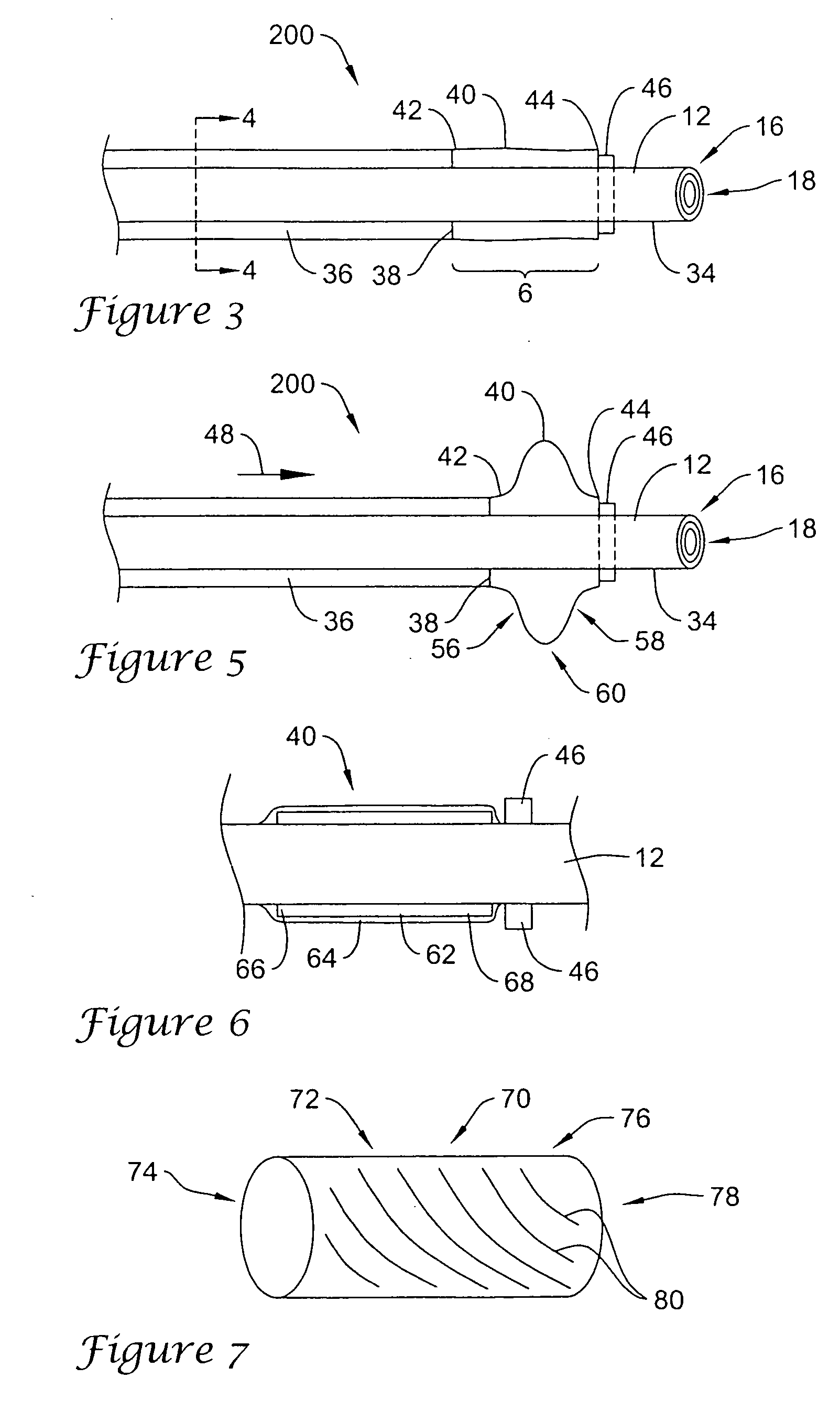 Catheter with distal occlusion