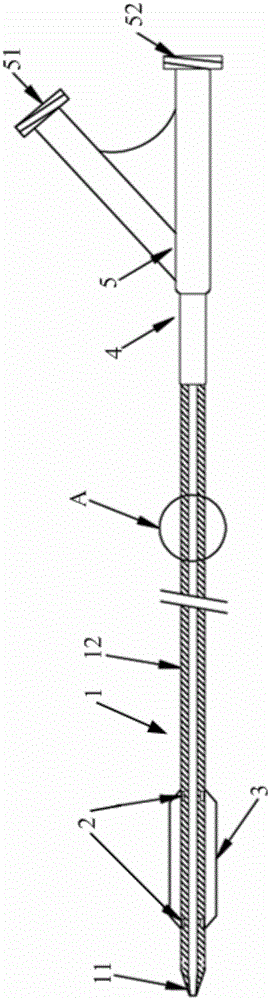 Balloon catheter