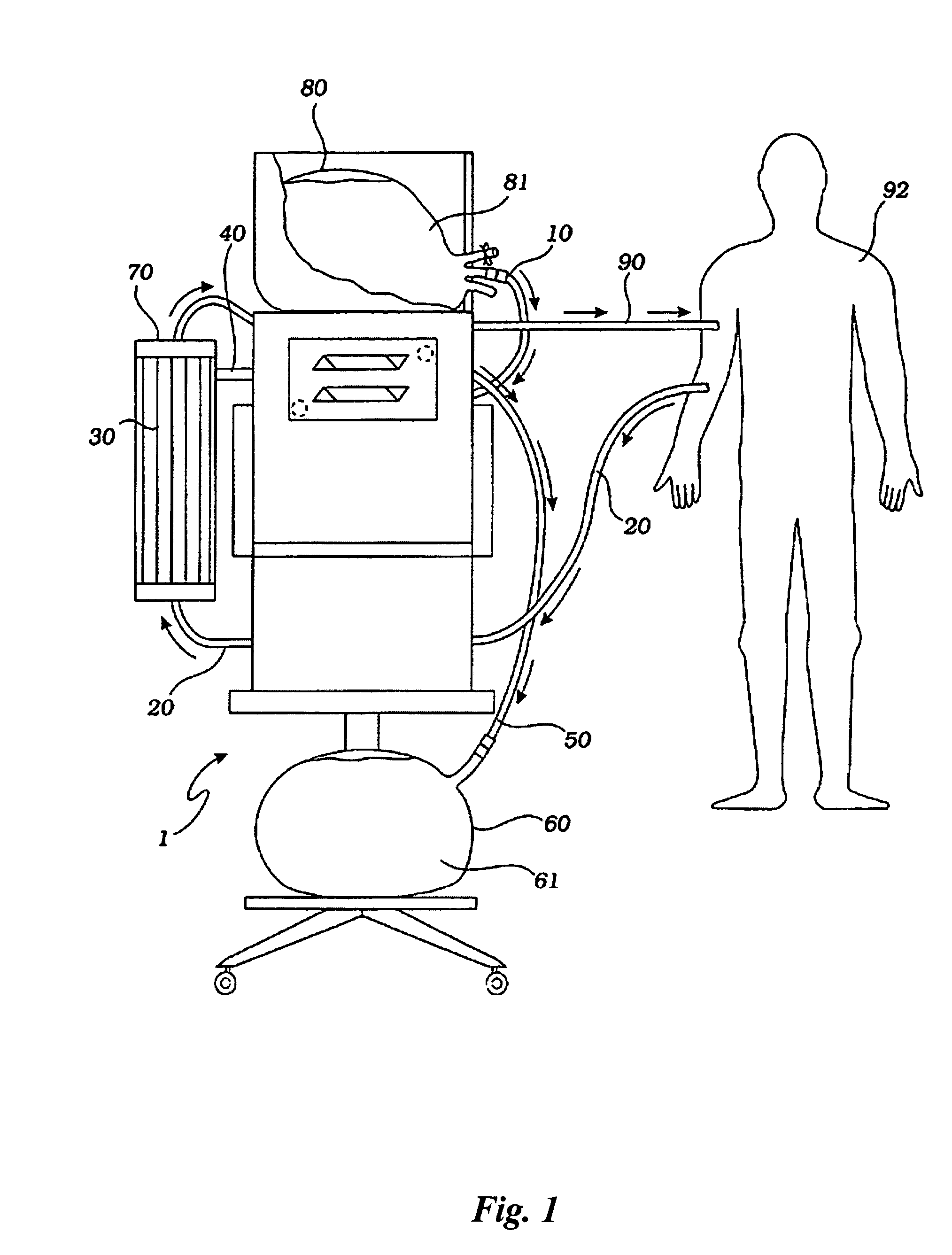 Fluid circuits, systems, and processes for extracorporeal blood processing