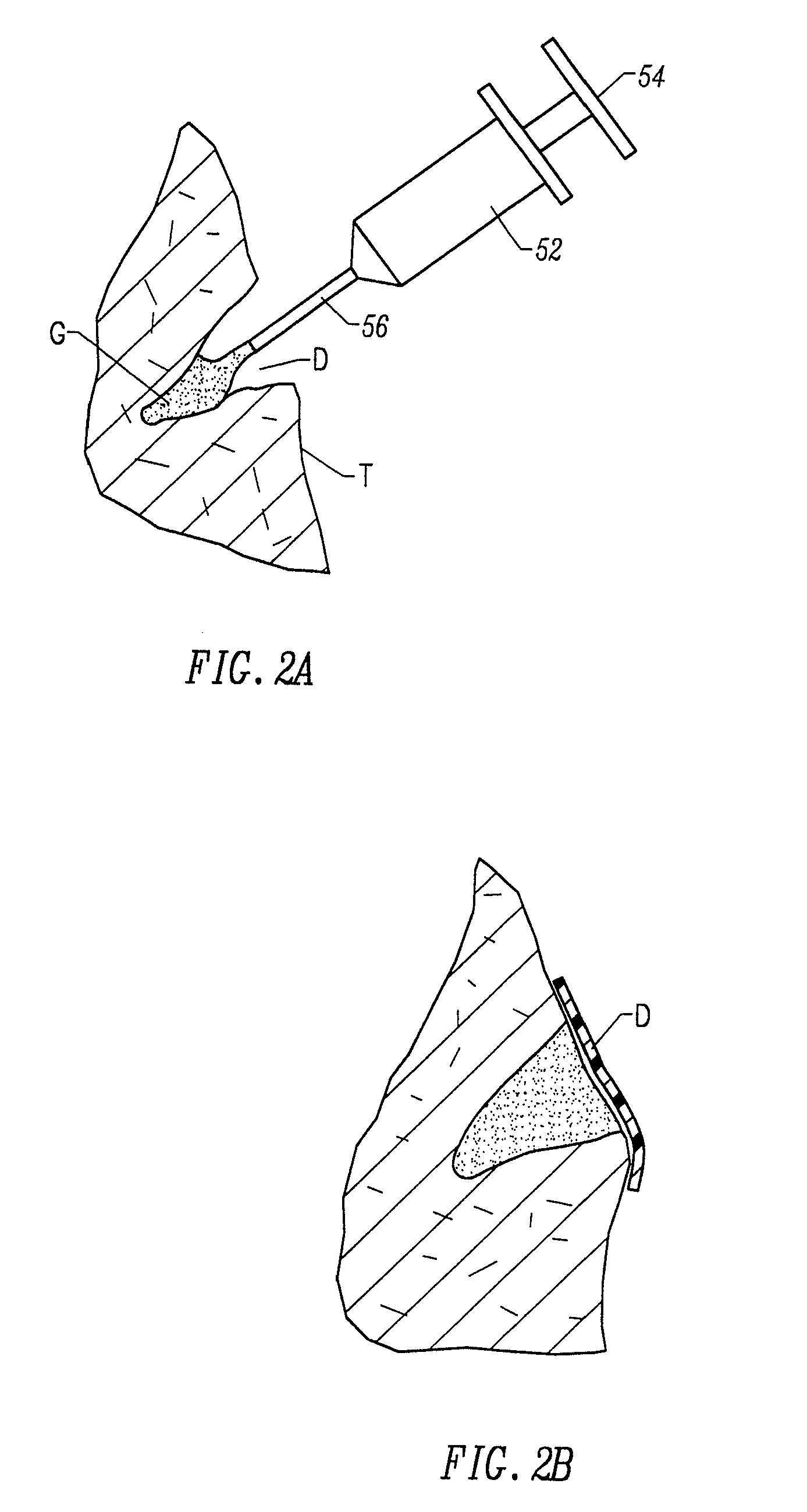 Fragmented polymeric compositions and methods for their use