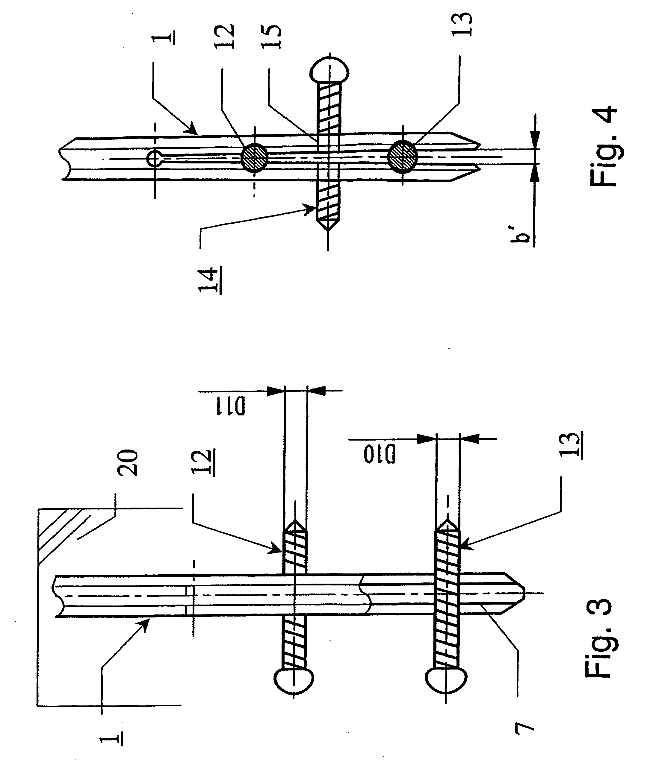 Intramedullary nail