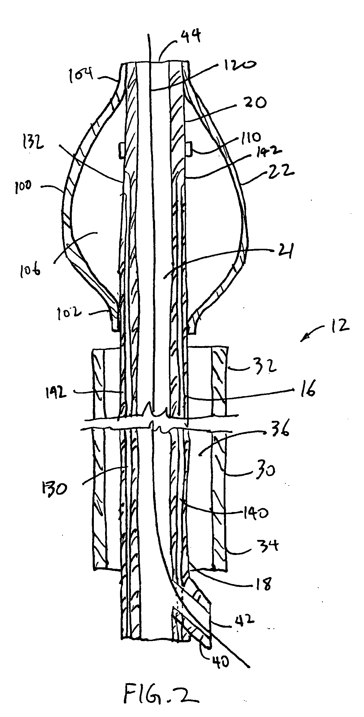 Methods and apparatus for tissue cryotherapy