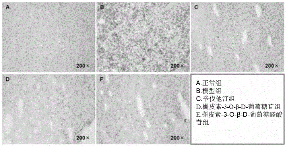 Application of quercetin-o-glycoside derivatives in the treatment of lipid metabolism disorders