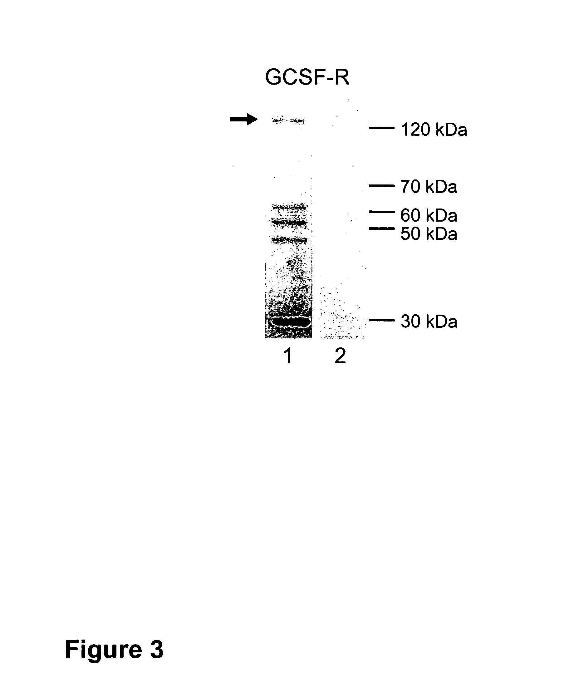 Methods of treating neurological conditions with hematopoietic growth factors