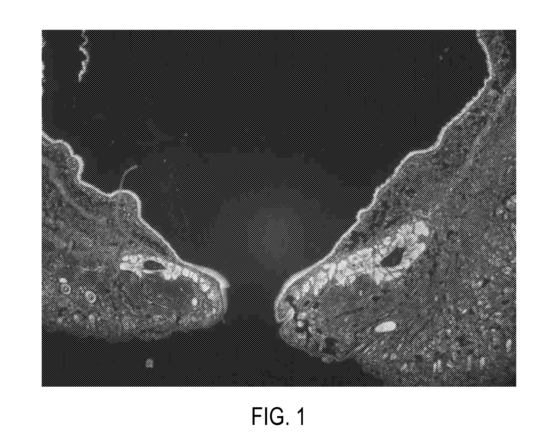 Method for treating ocular inflammation