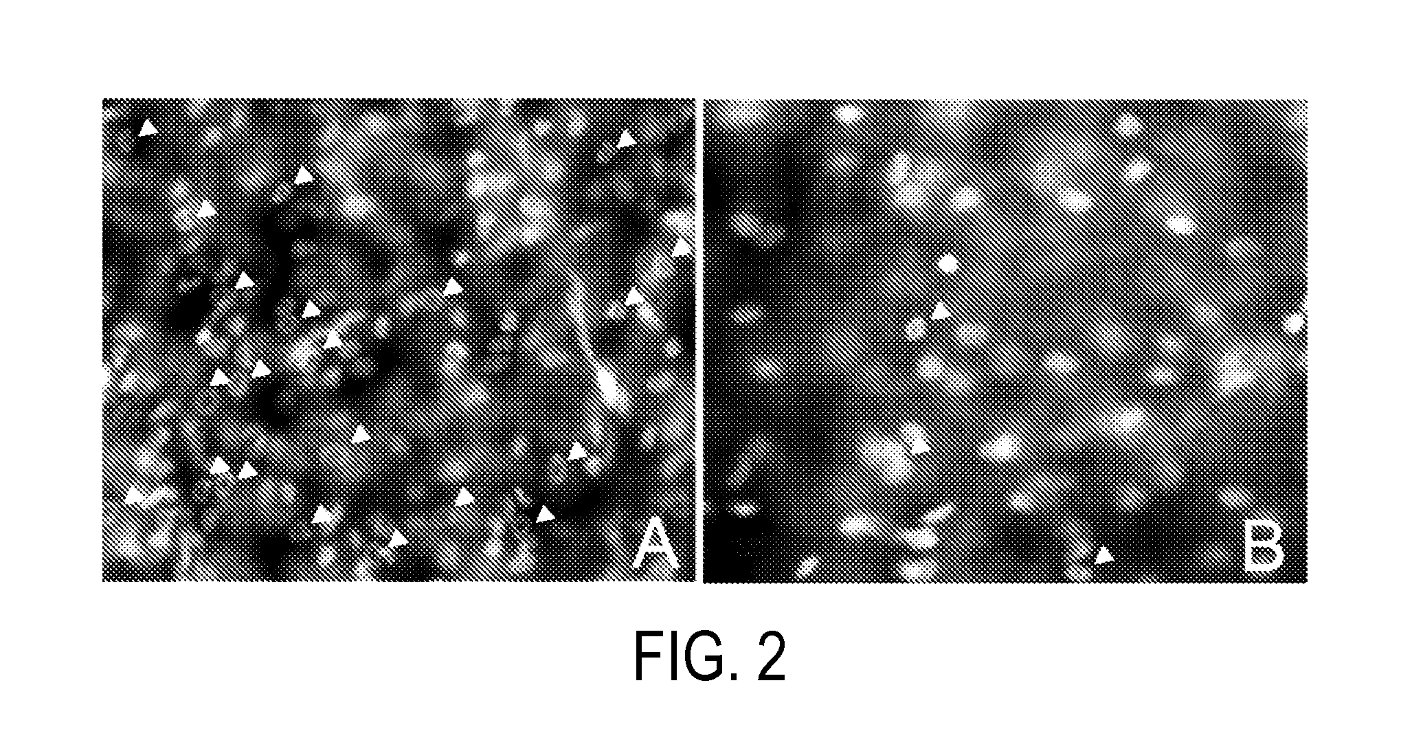 Method for treating ocular inflammation