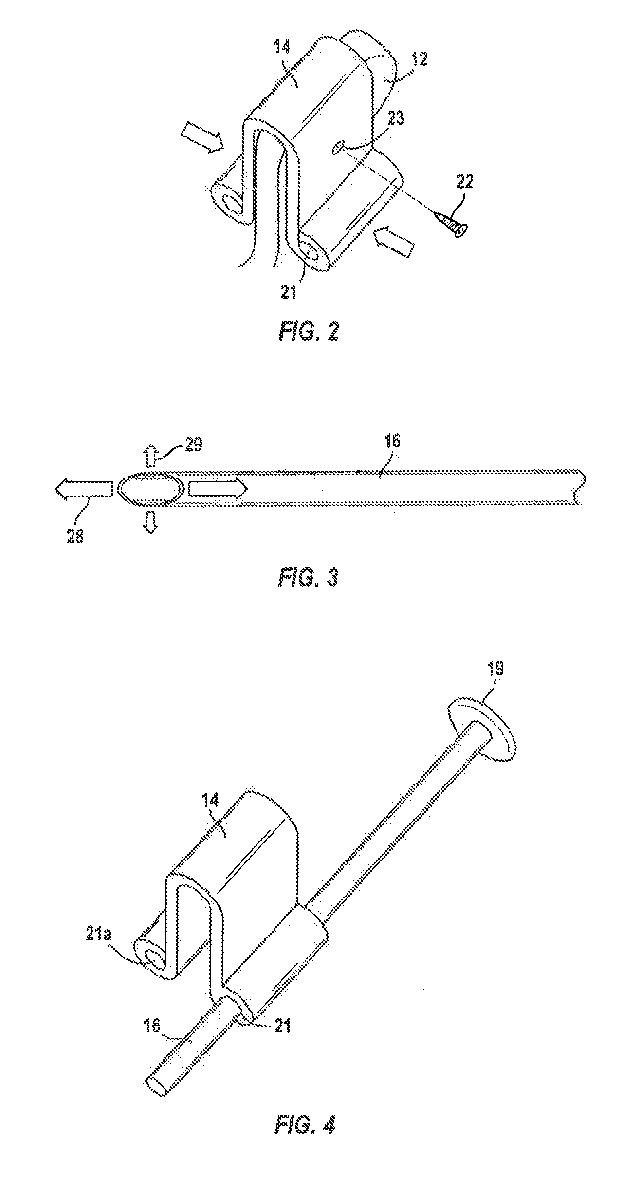 Orthosis to Correct Spinal Deformities