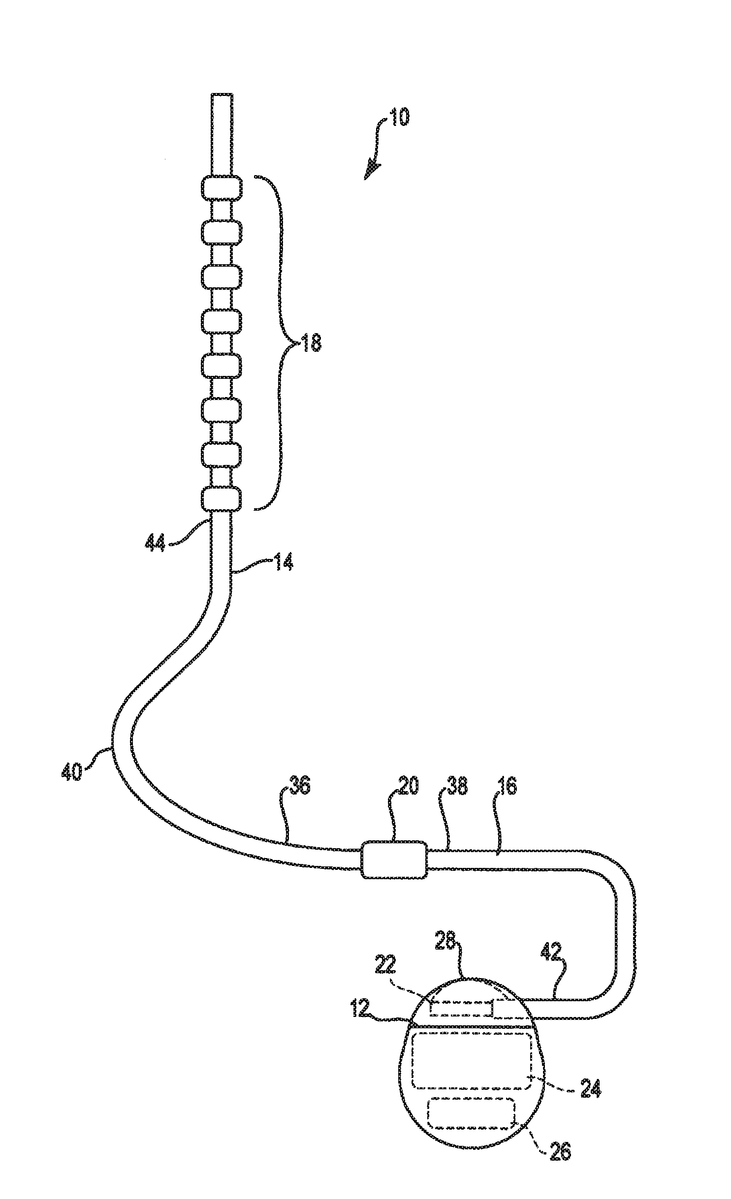 Lead identification system