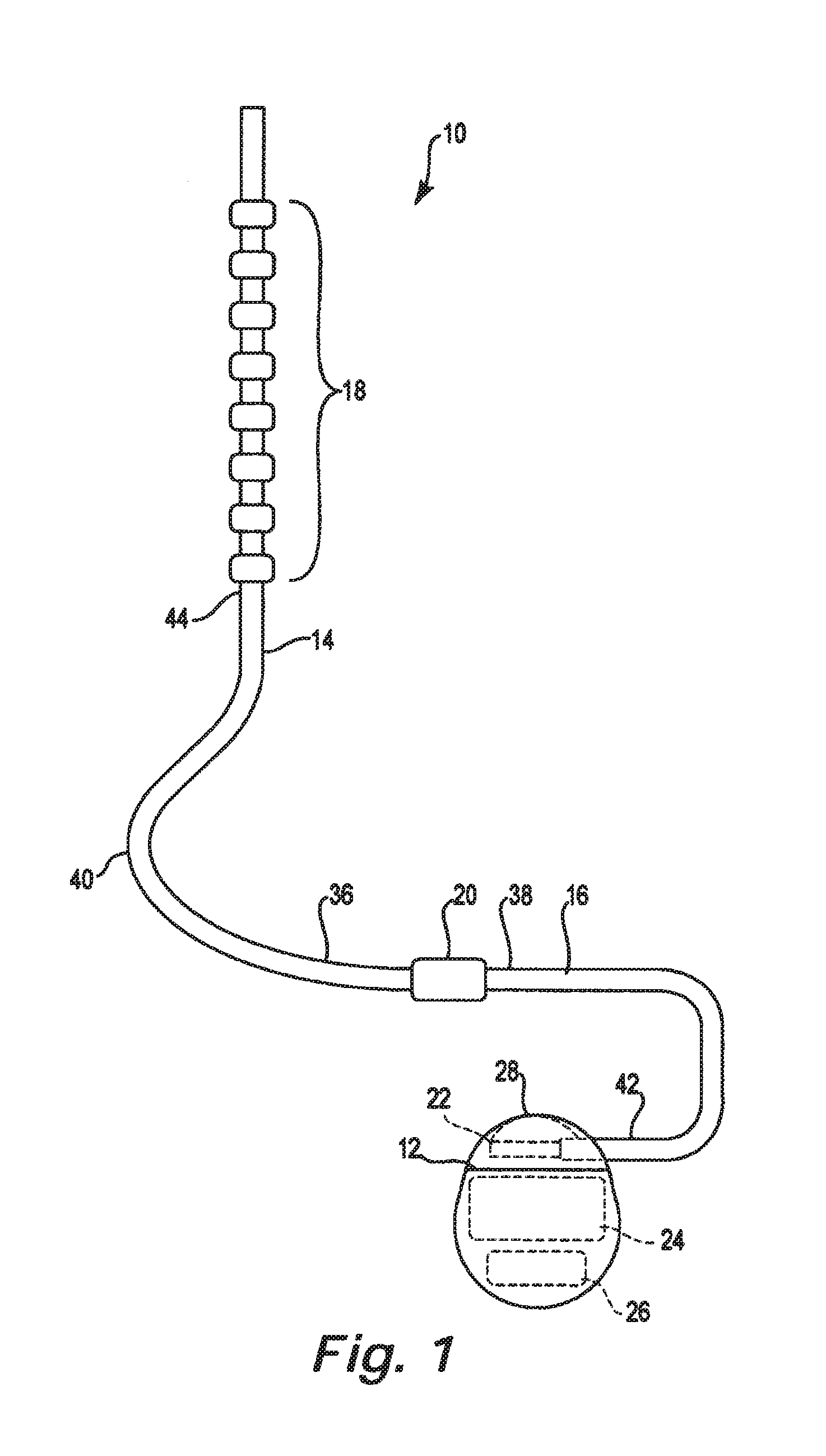 Lead identification system