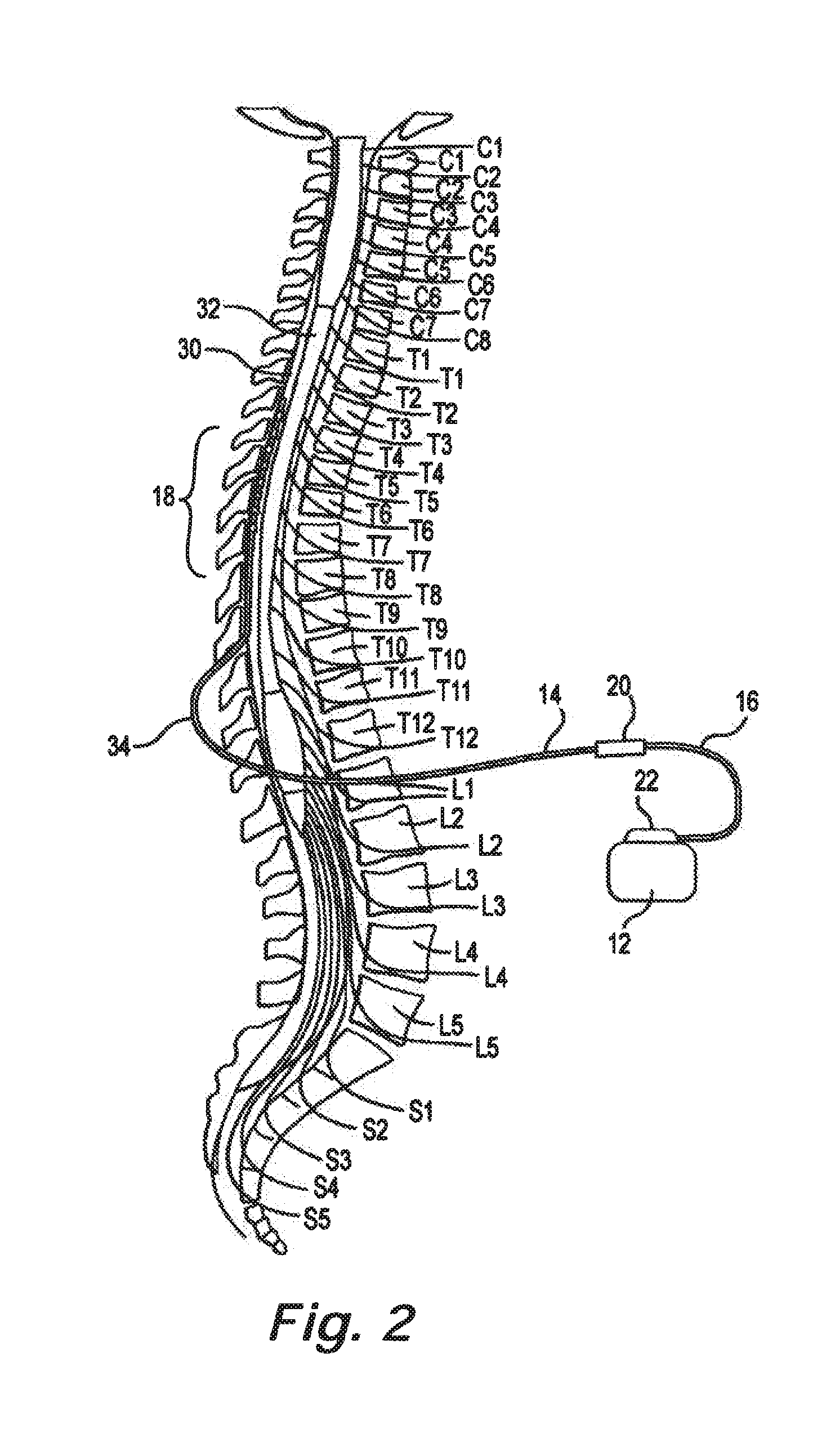 Lead identification system