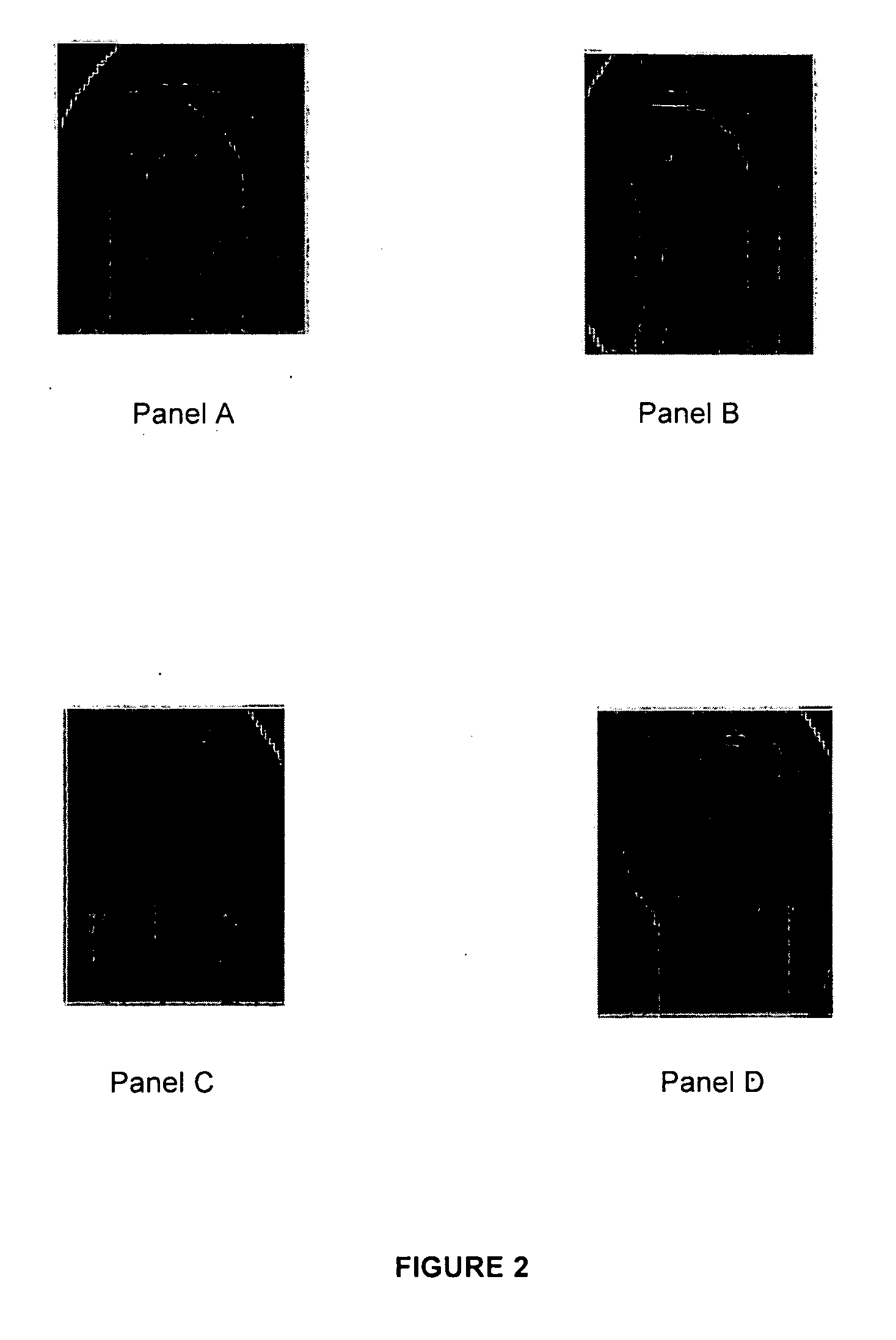 Column Design for Micro Gas Chromatograph