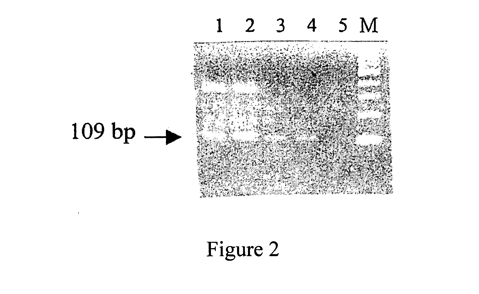 Helicobacter pylori antigens in blood