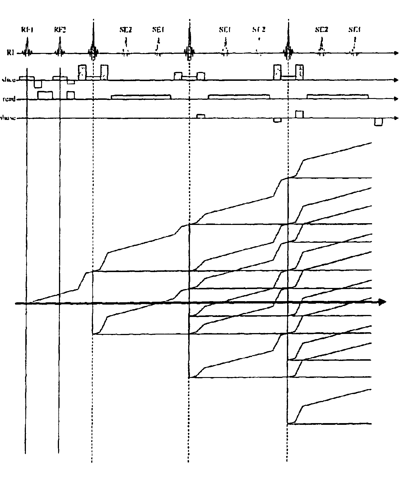 Method and apparatus for removing specific stimulated echoes in simultaneous image refocusing