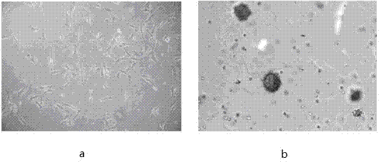 Induction culture medium and method for inducing human fat mesenchymal stem cells to generate insulin secreting cells