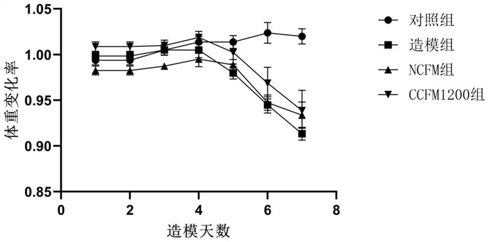 Lactobacillus acidophilus capable of relieving ulcerative colitis and application of lactobacillus acidophilus