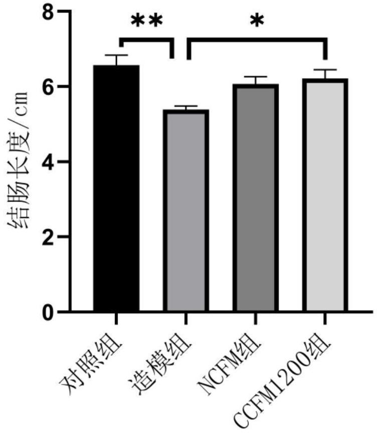 Lactobacillus acidophilus capable of relieving ulcerative colitis and application of lactobacillus acidophilus