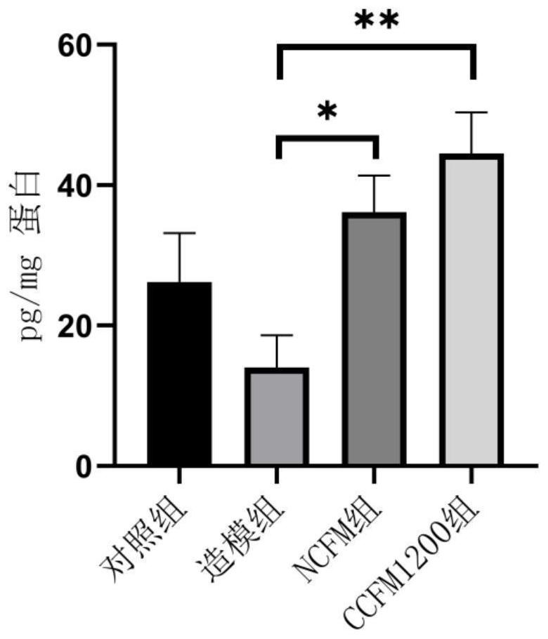 Lactobacillus acidophilus capable of relieving ulcerative colitis and application of lactobacillus acidophilus