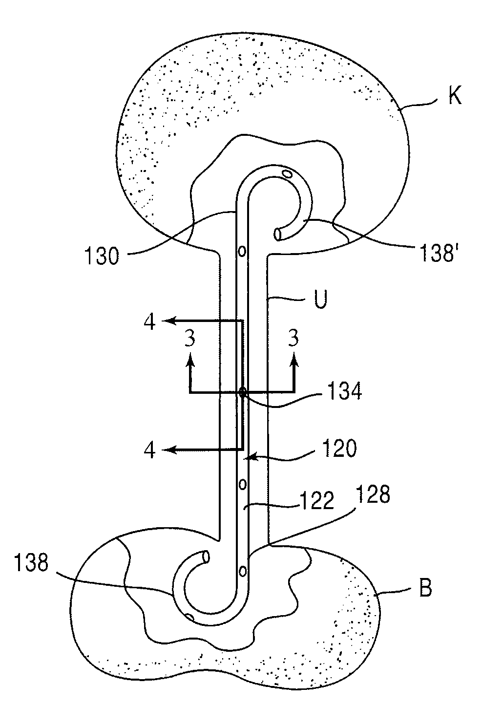 Stent Having Time-Release Indicator