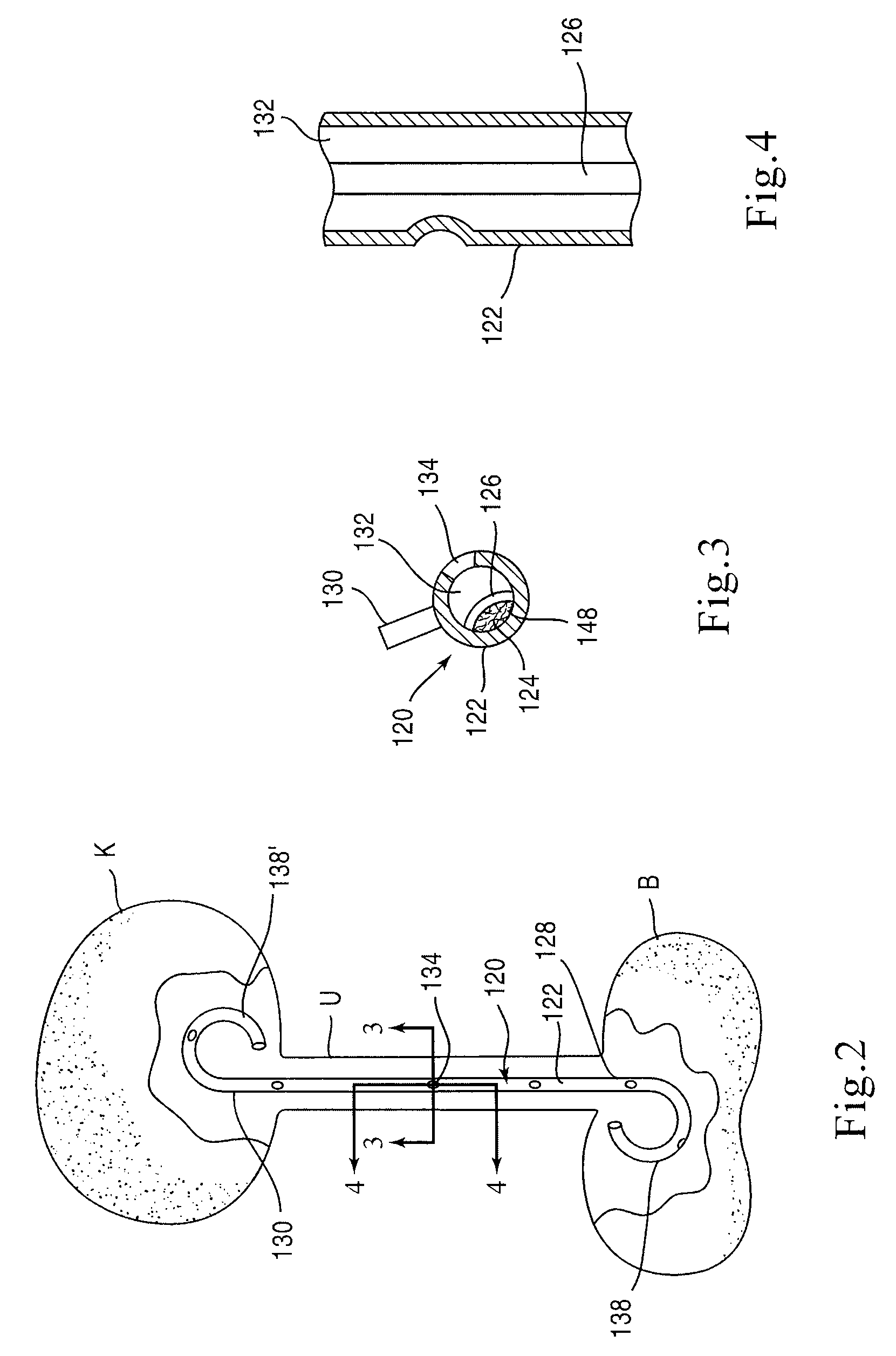 Stent Having Time-Release Indicator