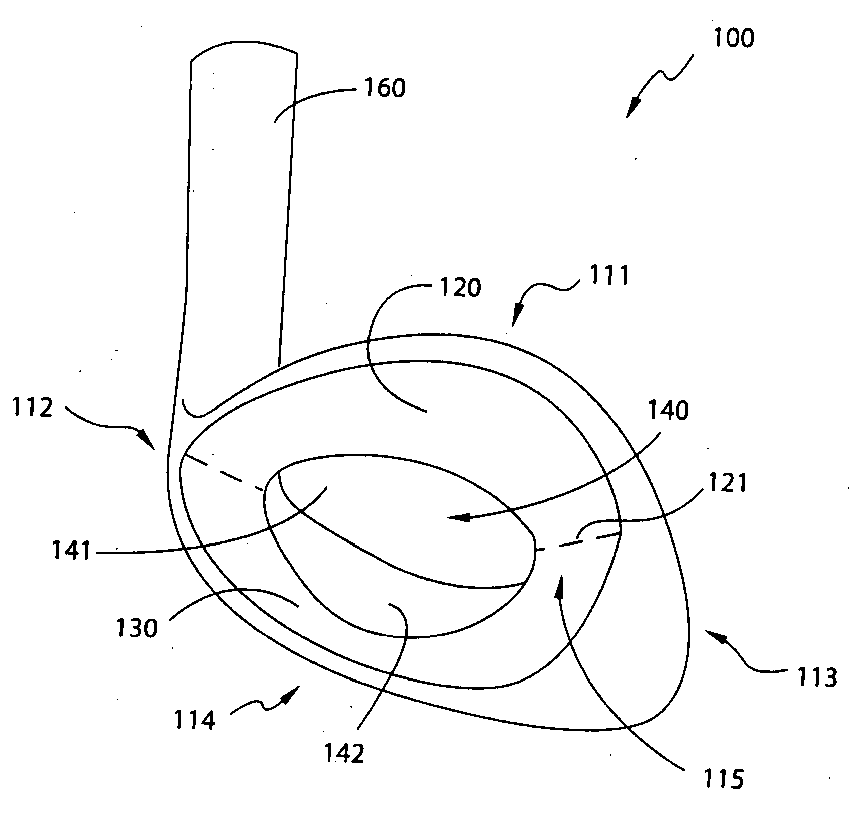 Muscle back, with insert, iron type golf club head