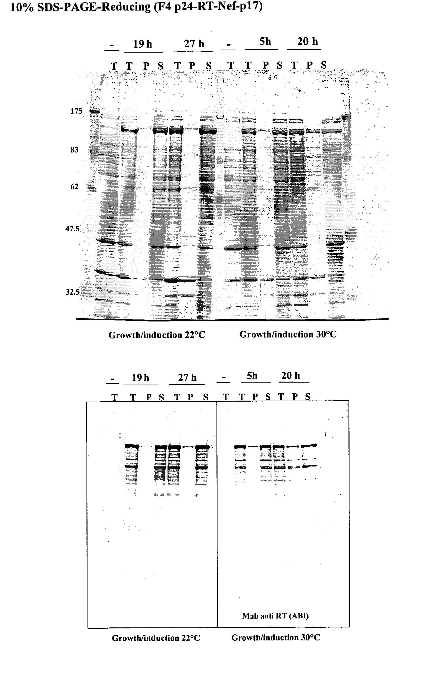 Vaccine for Prevention and Treatment of Hiv-Infection