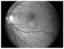 Eye fundus image-based cardiovascular and cerebrovascular disease occurrence type and risk prediction method and system, computer equipment and storage medium