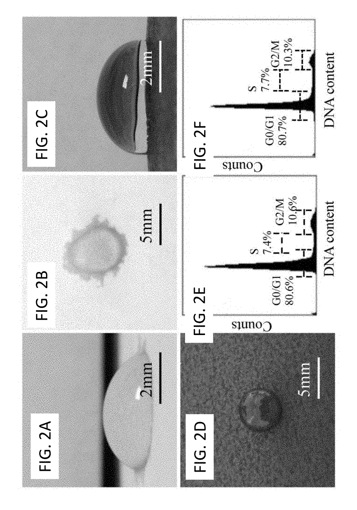 Disposable Single Cell Array for Personalized Diagnostics