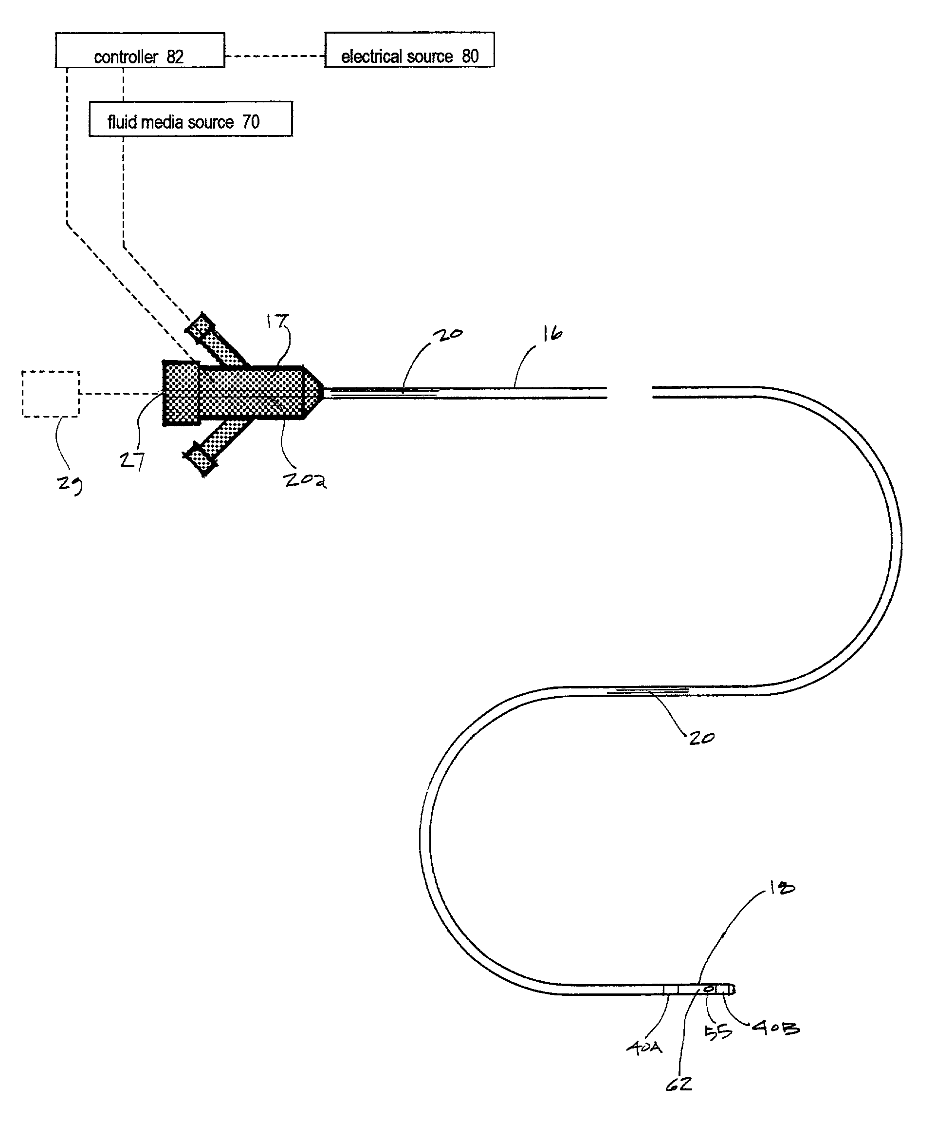 Electrical discharge catheter system for extracting emboli in endovascular interventions