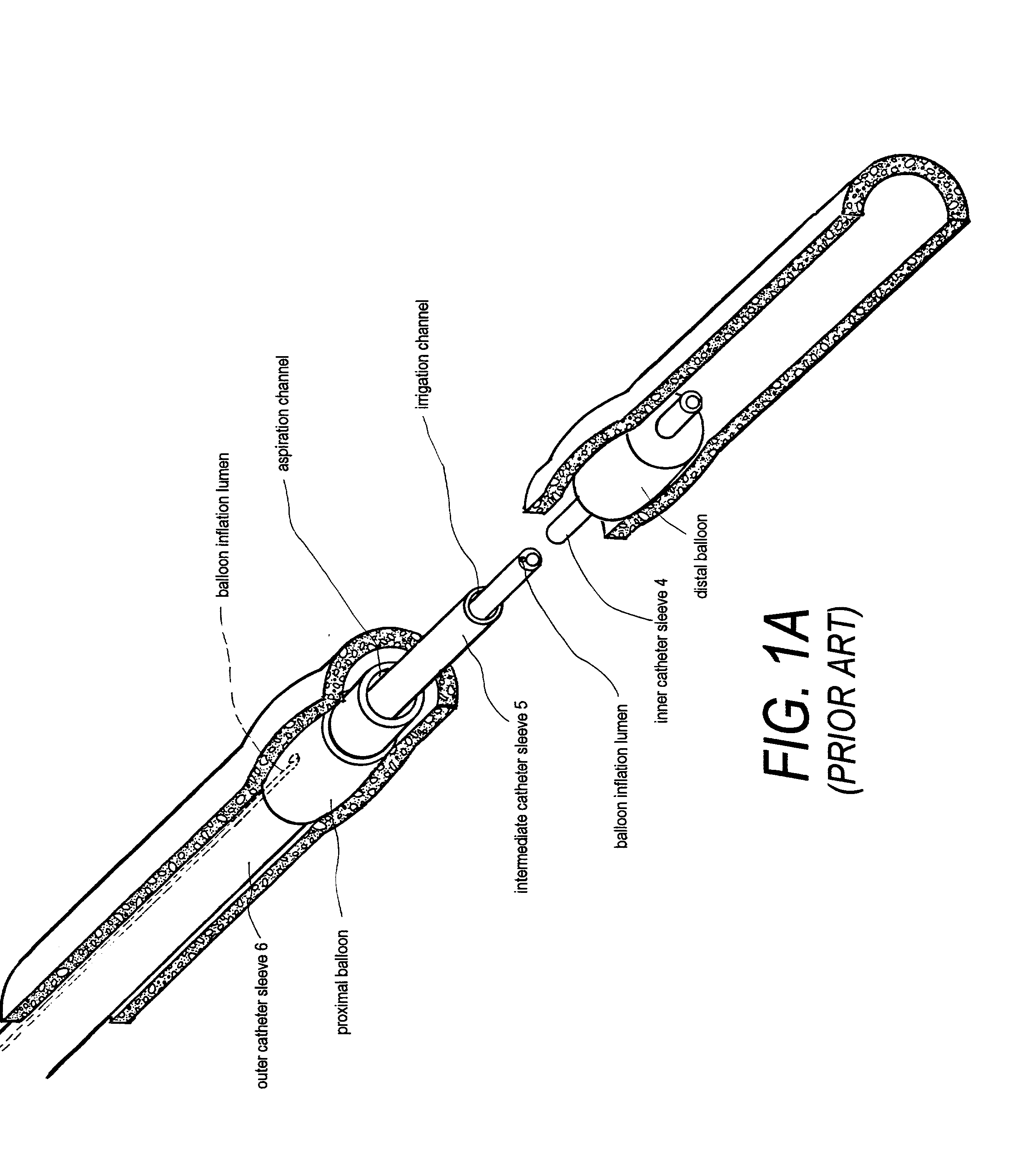 Electrical discharge catheter system for extracting emboli in endovascular interventions