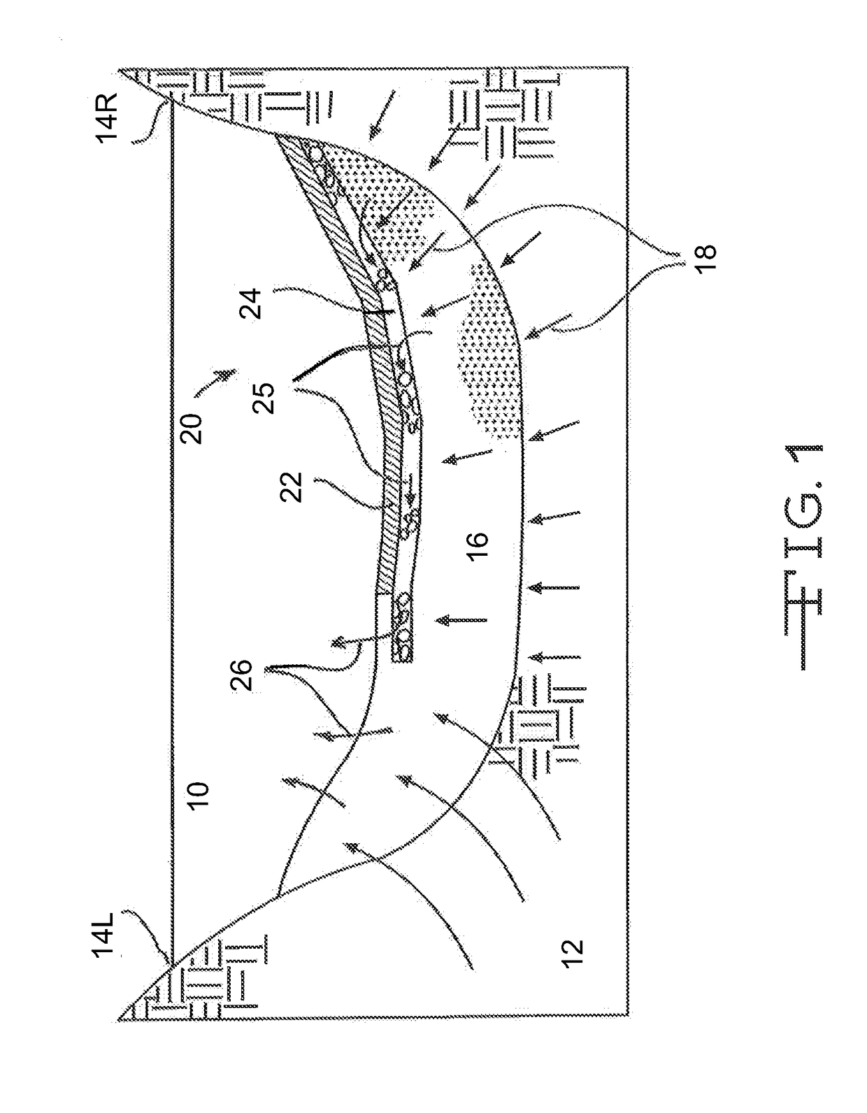 Self-Regenerating Remediation Treatments and Methods