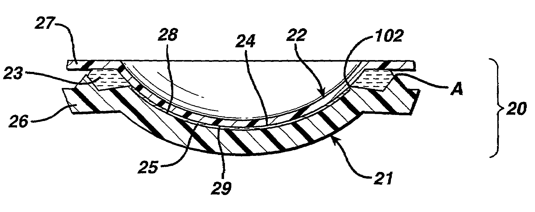 Mold for forming a contact lens and method of preventing formation of small strands of contact lens material during contact lens manufacture