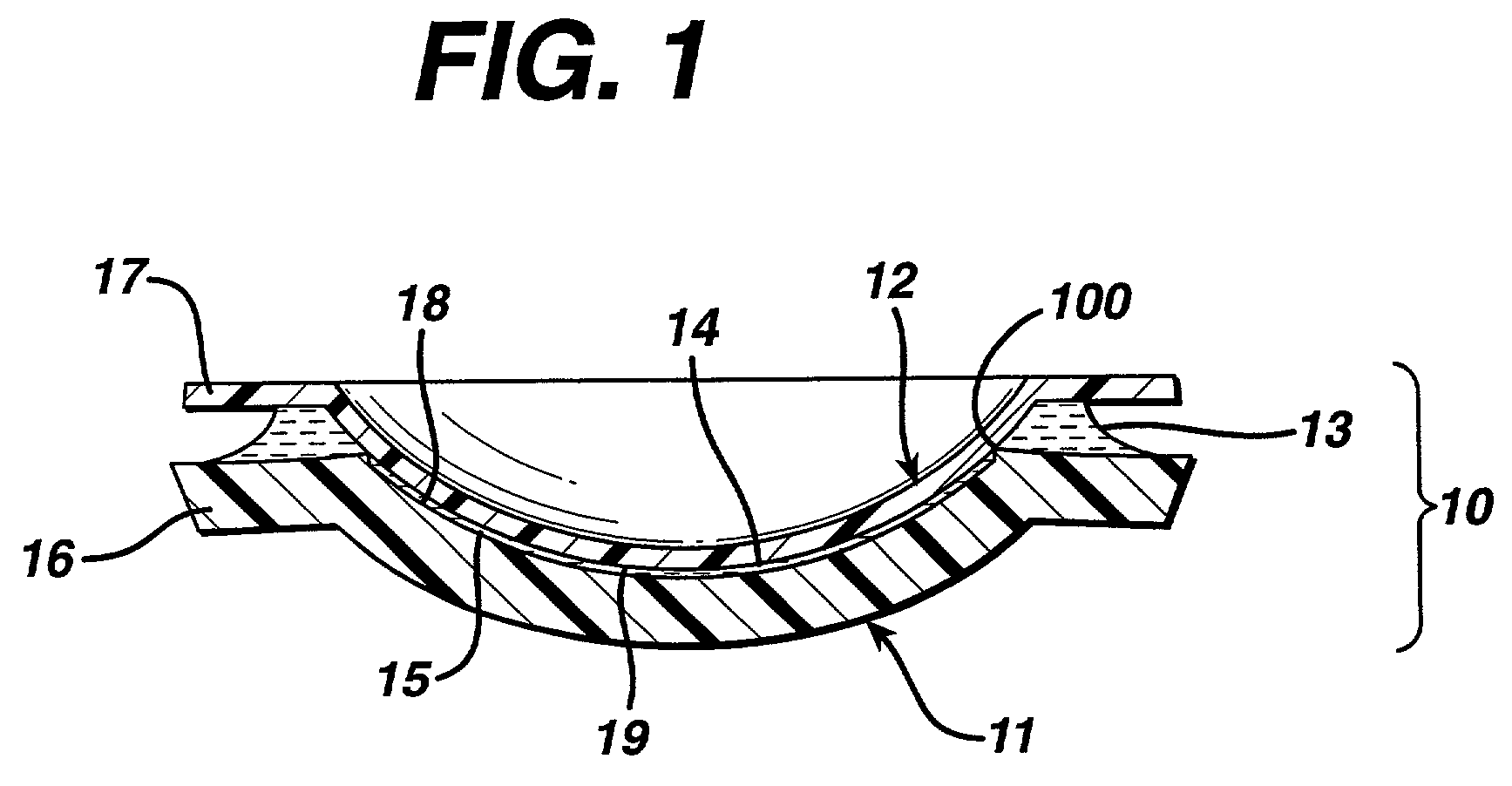 Mold for forming a contact lens and method of preventing formation of small strands of contact lens material during contact lens manufacture