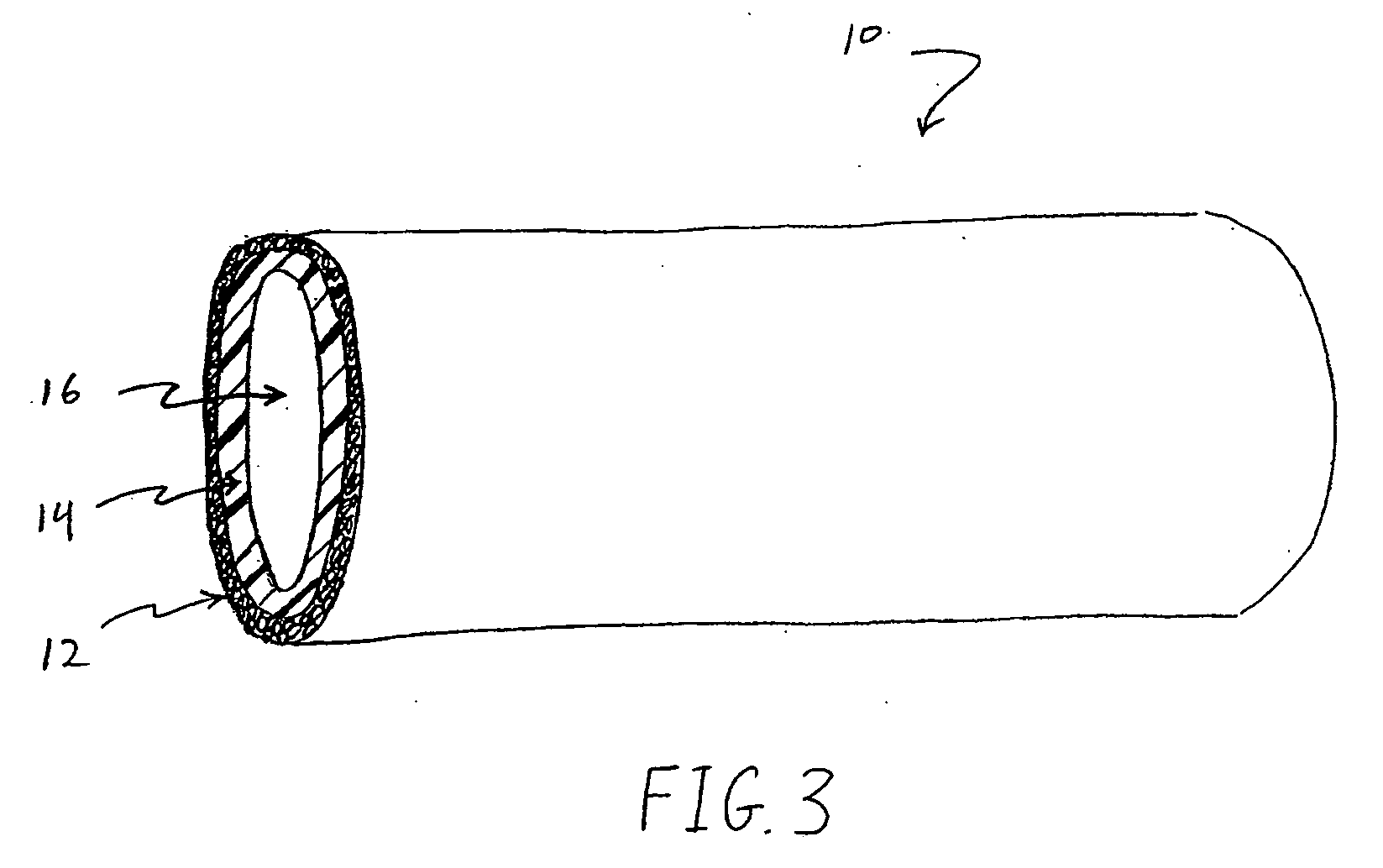 Method for loading nanoporous layers with therapeutic agent