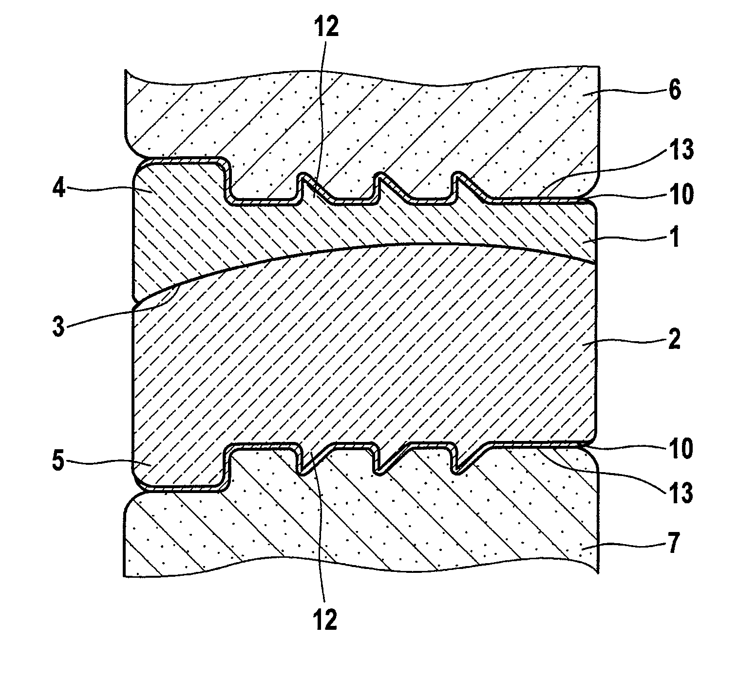 Endoprosthesis component