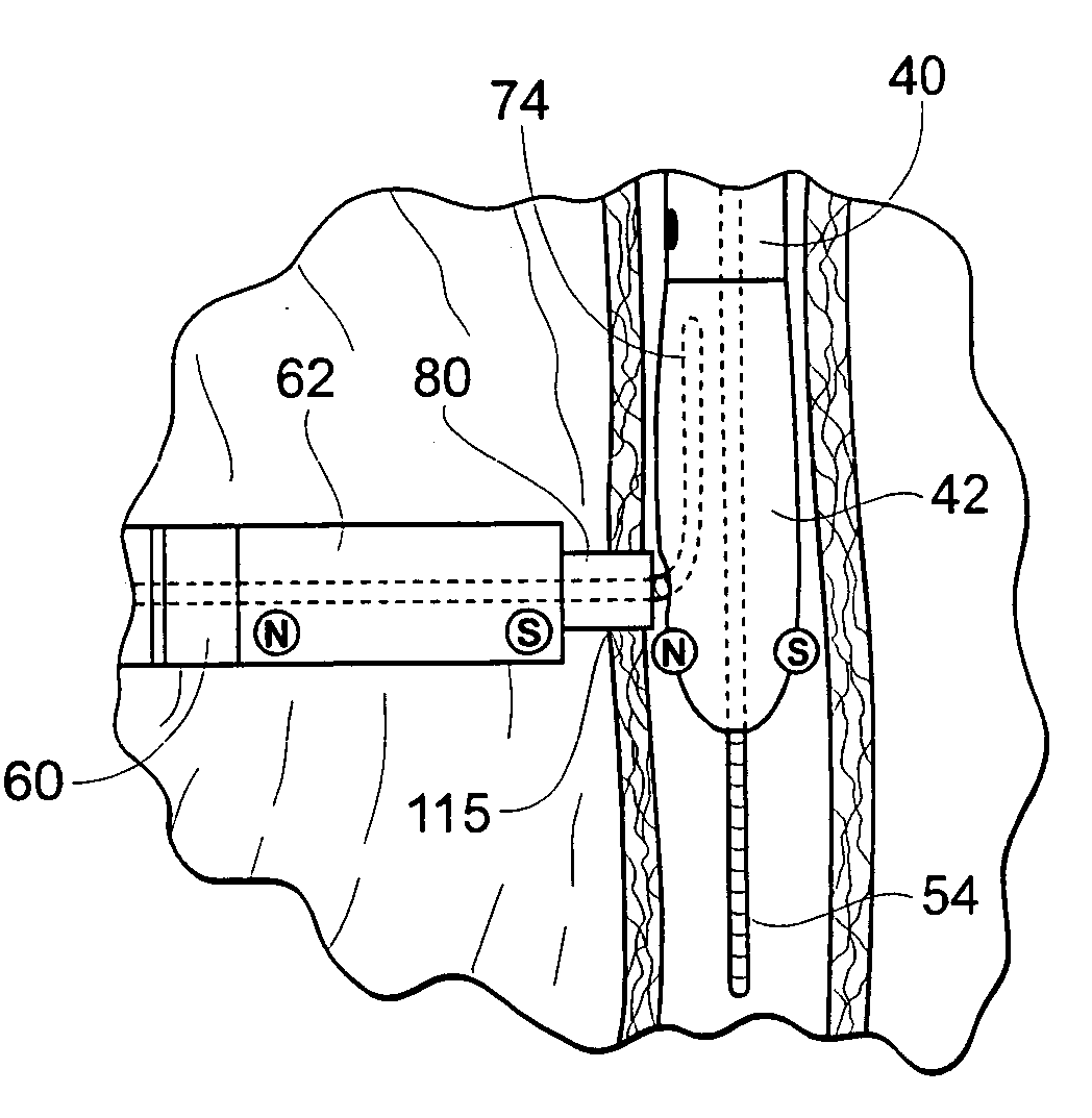 Devices, systems, and methods for reshaping a heart valve annulus, including the use of magnetic tools