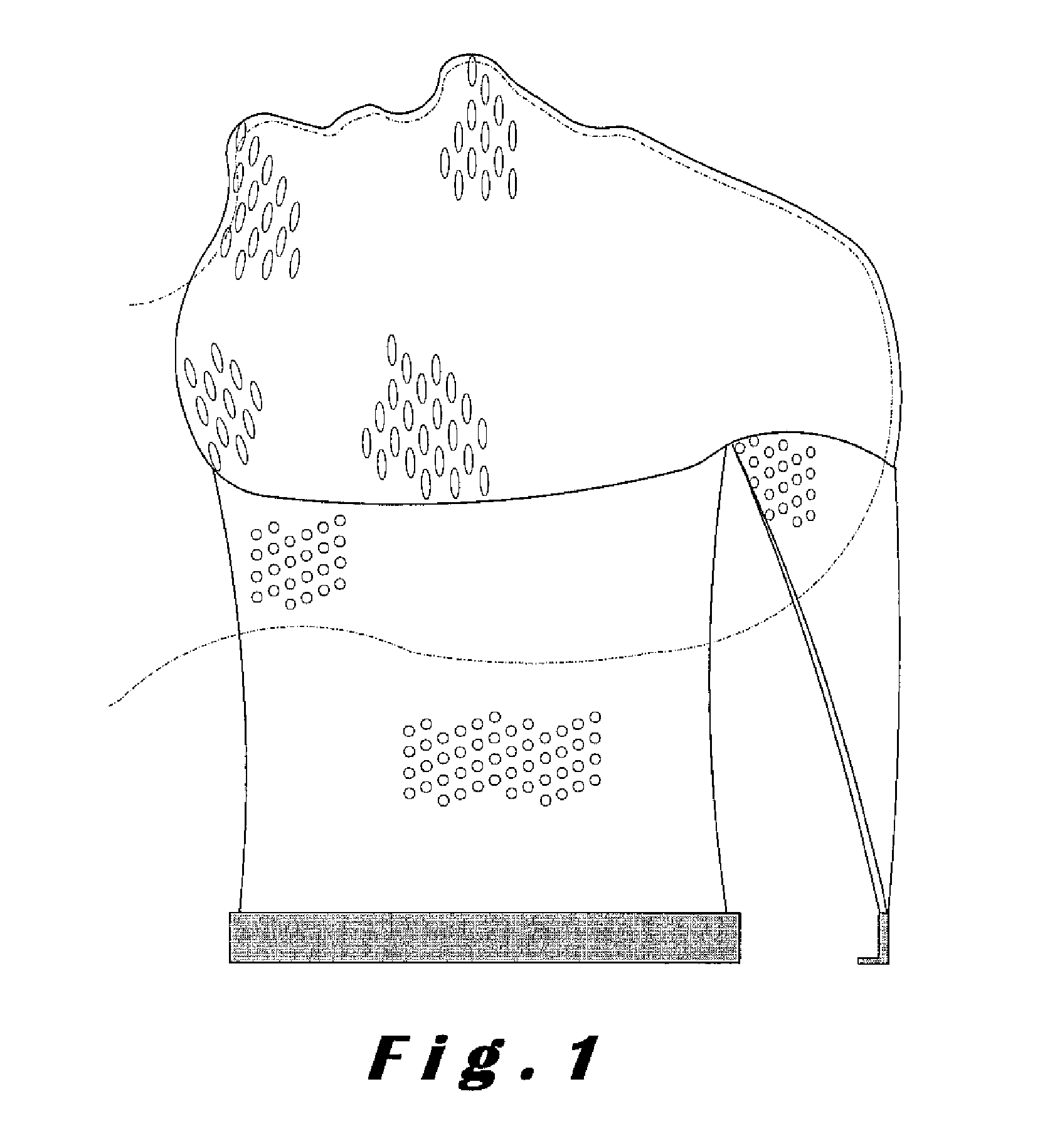 Immobilization device