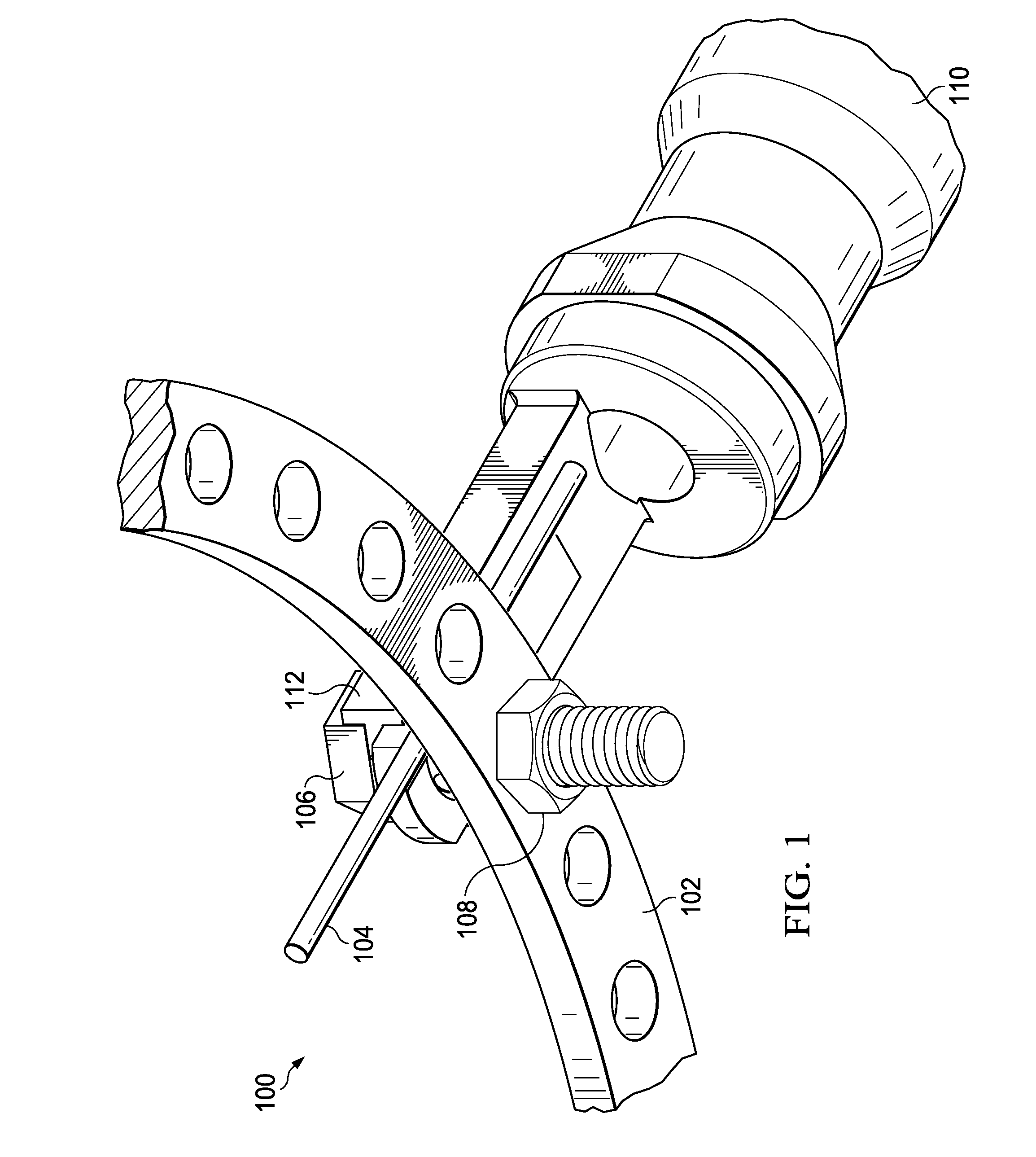 Wire tensioner tip for use with wire fixation bolt