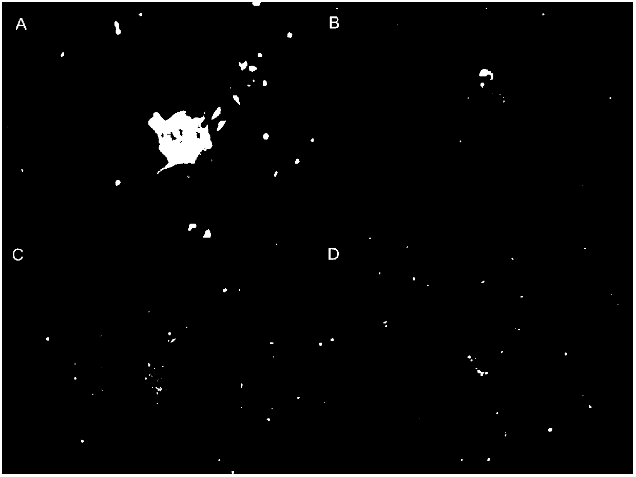 Nerve regeneration biogum and preparation method and application thereof