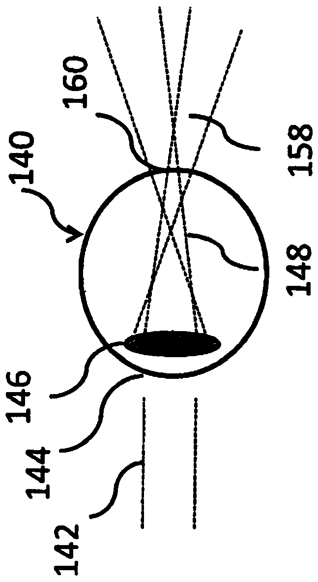 Lenses, devices, methods and systems for refractive error