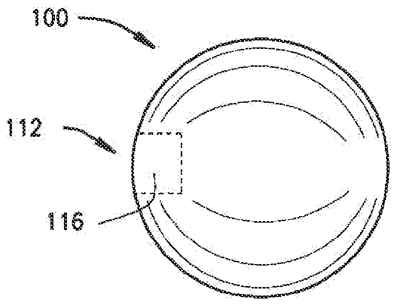 Expandable body device and method of use